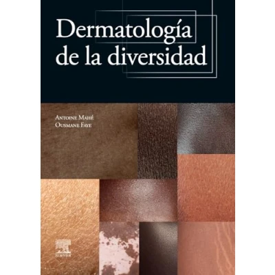 Imagen de Dermatología de la diversidad