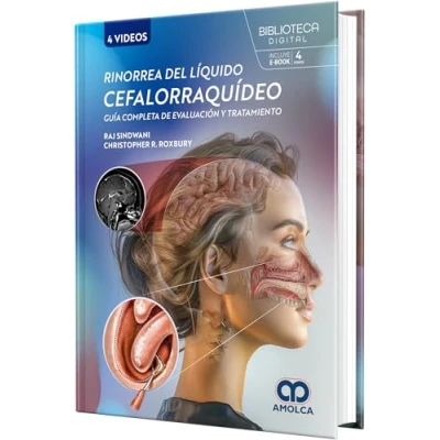 Imagen de Rinorrea Del Líquido Cefalorraquídeo. Guía Completa De Evaluación Y Tr