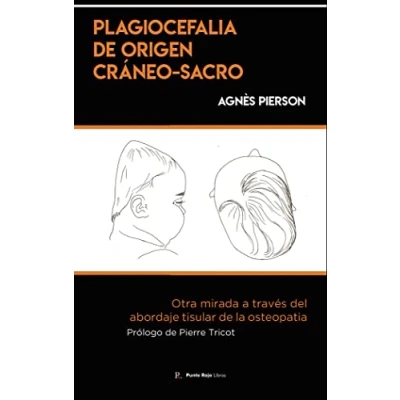 Imagen de Plagiocefalia de origen cráneo sacro