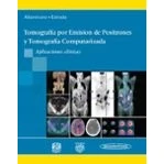Imagen de tomografia por emision de positrones y