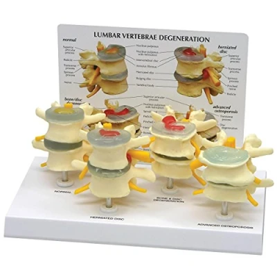Imagen de GPI Anatomicals Conjunto de modelo vértebras, 4 fases