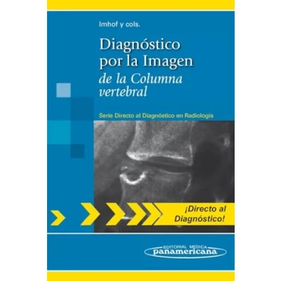 Imagen de diagnostico por la imagen de columna vertebral (Directo al en radiologia / Direct Diagnosis in Radiology)