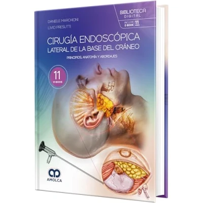 Imagen de Cirugía Endoscópica Lateral De La Base Del Cráneo. Principios Anatomía