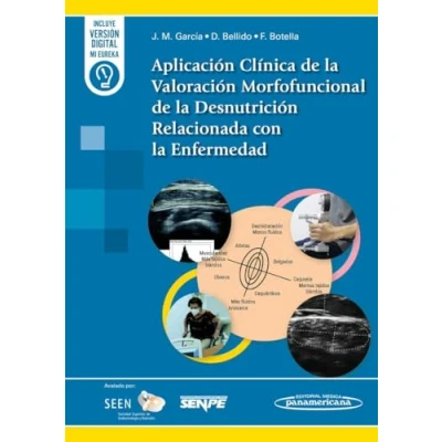 Imagen de Aplicación Clínica de la Valoración Morfofuncional Desnutrición Relacionada con Enfermedad
