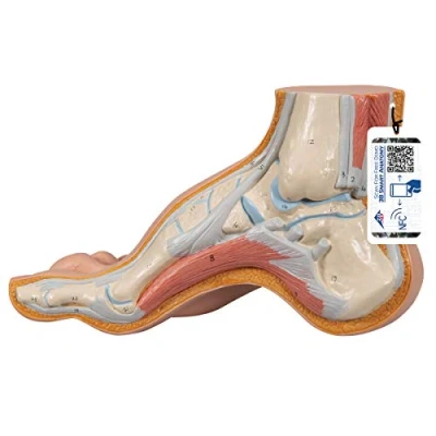 Imagen de 3B Scientific M32 Modelo de anatomía humana Pie Arqueado, Pes Cavus + App gratuita Smart Anatomy