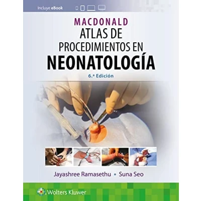 Imagen de MacDonald. Atlas de procedimientos en neonatología