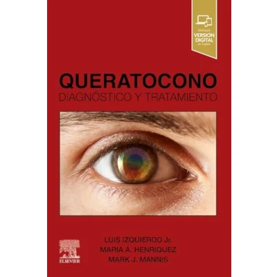 Imagen de Queratocono