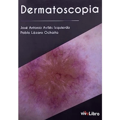 Imagen de Dermatoscopia (SIN COLECCION)