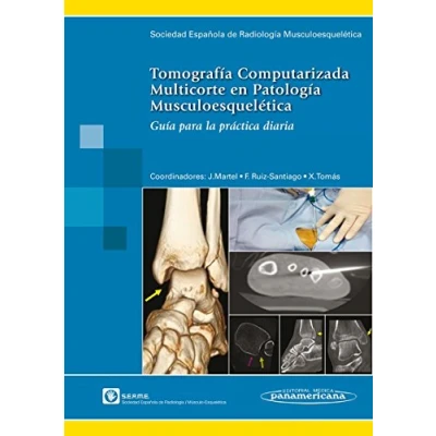 Imagen de Tomografia computarizada multicorte en patologia m: Guía para la práctica diaria