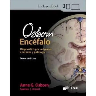 Imagen de Osborn Encéfalo. Diagnóstico Por Imágenes Anatomía Y Patologia