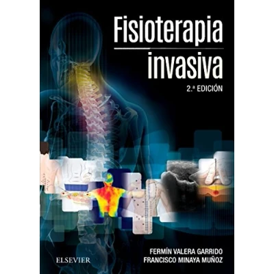 Imagen de Fisioterapia Invasiva + Acceso Web 2ª Edición