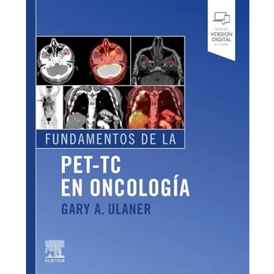 Imagen de Fundamentos de la PET TC en oncología