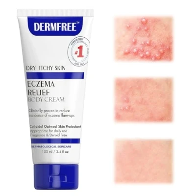 Imagen de 100g ungüento para Eccema, loción corporal pieles propensas a eczemas, calmante e hidratante, Crema hidratante