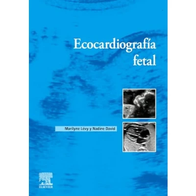 Imagen de Ecocardiografía fetal