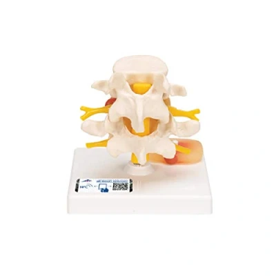 Imagen de 3B Scientific A76 Modelo Anatómico Humano Discos Vertebrales Lumbares Con Hernia Discal + App de anatomía gratuita Smart Anatomy