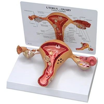 Imagen de GPI Anatomicals Modelo de útero ovario
