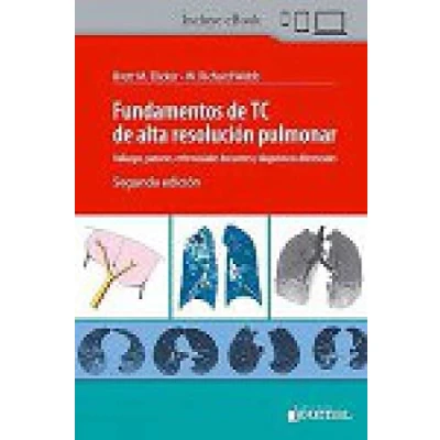 Imagen de FUNDAMENTOS DE TC ALTA RESOLUCION PULMONAR HALLAZGOS