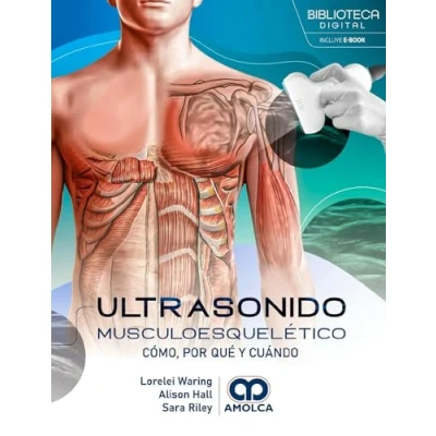Imagen de ULTRASONIDO MUSCULOESQUELETICO COMO POR QUE Y CUANDO