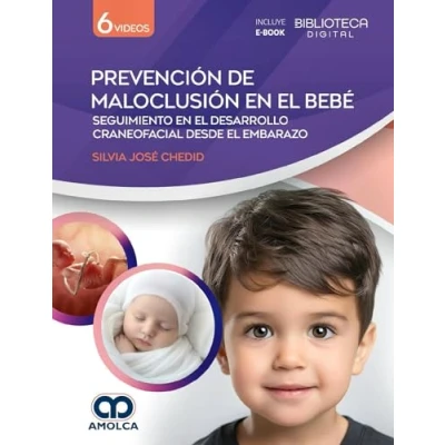 Imagen de PREVENCION DE MALOCLUSION EN EL BEBE SEGUIMIENTO DESA