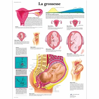 Imagen de 3B Scientific, 1