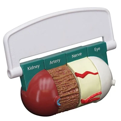 Imagen de GPI Anatomicals Modelo de diabetes 4 piezas