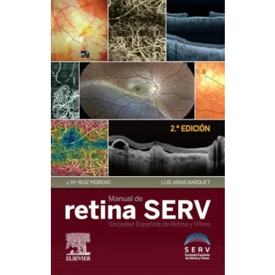 Imagen de Manual De Retina Serv 2ª Edición