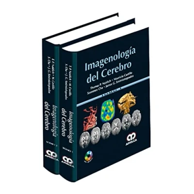 Imagen de Imagenologia Del Cerebro (2 Vols. + Dvd)