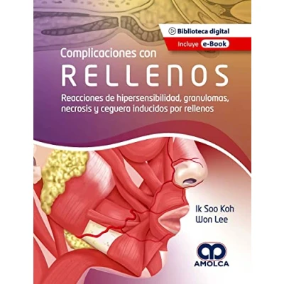 Imagen de KOH COMPLICACIONES CON RELLENOS REACCIONES DE HIPERSENSIBIL