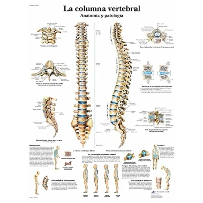 Imagen de 3B Scientific VR3152UU Impreso En Papel, la Columna Vertebral, Anatomía y Patología