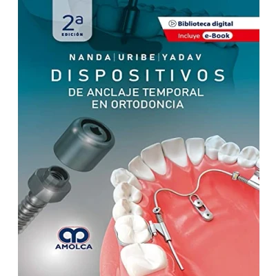 Imagen de NANDA DISPOSITIVOS DE ANCLAJE TEMPORAL EN ORTODONCIA