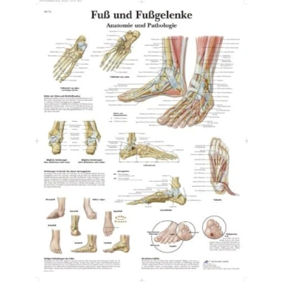Imagen de 3B Scientific VR0176L Póster explicativo sobre la Anatomía del Pie y tobillos patología (en alemán Fuß und Fußgelenke Anatomie Pathologie)