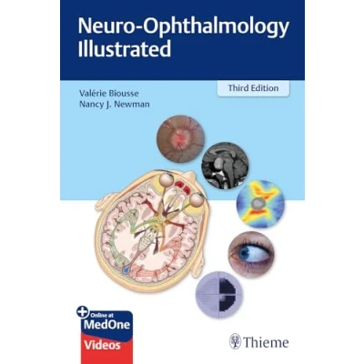 Imagen de Neuro ophtalmology Illustrated