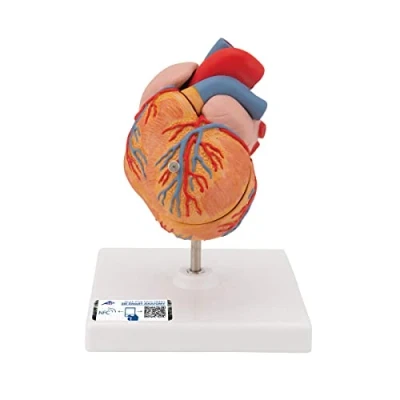 Imagen de 3B Scientific G04 Corazón Clásico Con Hipertrofia Ventricular Izquierda (Hvi), de 2 Piezas + App anatomía gratuita Smart Anatomy
