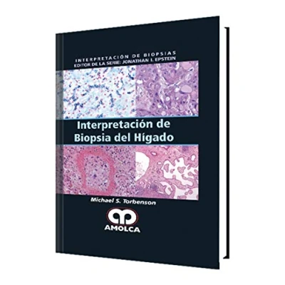 Imagen de INTERPRETACION DE BIOPSIA DEL HIGADO