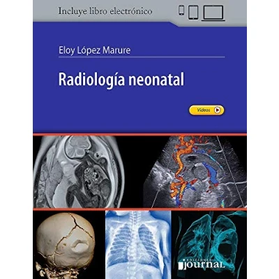 Imagen de Radiología Neonatal (incluye Libro Electrónico)