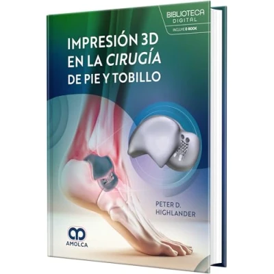 Imagen de Impresión 3d En La Cirugía De Pie Y Tobillo