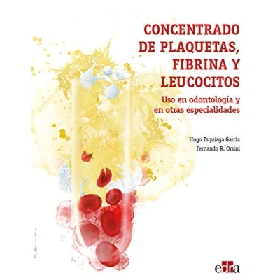 Imagen de Concentrado de plaquetas, fibrina y leucocitos