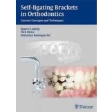 Imagen de Self ligating Brackets In Orthodontics: Current Concepts And Tech Niqu