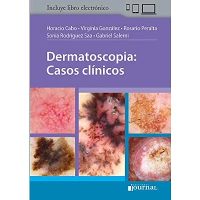 Imagen de DERMATOSCOPIA CASOS CLINICOS