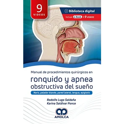 Imagen de MANUAL DE PROCEDIMIENTOS QUIRURGICOS EN RONQUIDO Y APNEA OB