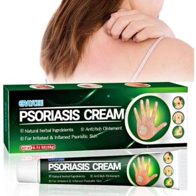 Imagen de Crema Anti Picazón 20 g, Antifúngica Para la Piel alivia el Picazón, Eficaz Reducción de Tiña Pedis, Eczema, Aliviar Picor Enrojecimiento las Irritaciones Cutáneas en Cuerpo Cara