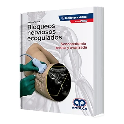 Imagen de Bloqueos Nerviosos Ecoguiados. Sonoanatomía Básica Y Avanzada