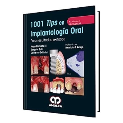 Imagen de 1001 Tips En Implantologia Oral Para Resultados Exitosos + Videos Onli