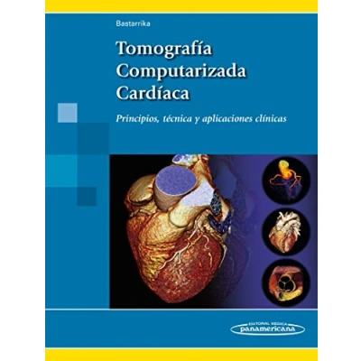 Imagen de Tomografia computarizada cardiaca: Principios, técnica y aplicaciones clínicas