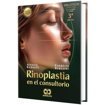 Imagen de Rinoplastia En El Consultorio