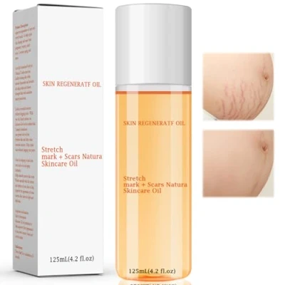 Imagen de Aceite De Corporal Antiestrias Embarazo,Reparación Postnatal Desvanece La Cicatriz Para El Cuidado Piel Seca,Aceite Estrias Embarazo Y Embarazo,125ML