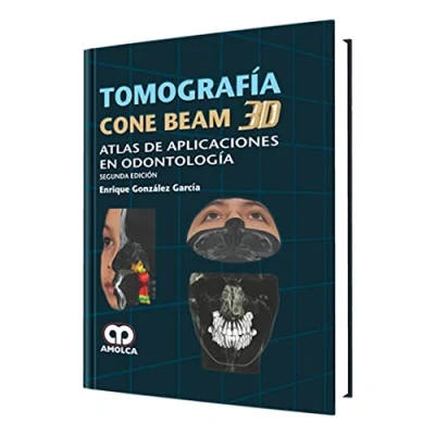 Imagen de GONZALEZ TOMOGRAFIA CONE BEAN 3D ATLAS DE APLICACIONES EN