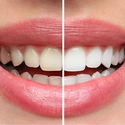 Imagen de President Hilo interdental blanco de nailon, con citrato sodio y liquen islandés, acción antisarro blanqueante. Indicado durante los tratamientos contra las discromías del esmalte. 50 metros