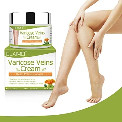 Imagen de Crema para Varices 50G circulación sanguínea en las piernas, venas varicosas, alivio de flebitis, mejorar la inflamación los vasos