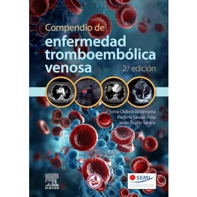 Imagen de Compendio de enfermedad tromboembólica venosa, 2.ª edición